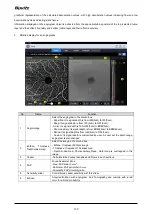 Preview for 130 page of Huvitz HOCT-1 User Manual