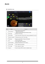 Предварительный просмотр 22 страницы Huvitz HOCT-1F/1 User Manual