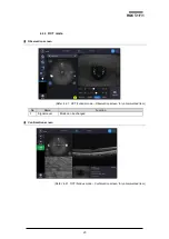 Предварительный просмотр 23 страницы Huvitz HOCT-1F/1 User Manual