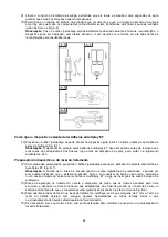 Preview for 89 page of HyperBranch Adherus AutoSpray ET Dural Sealant Instructions For Use Manual