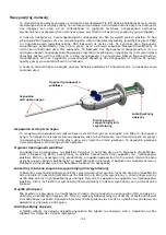 Preview for 155 page of HyperBranch Adherus AutoSpray ET Dural Sealant Instructions For Use Manual