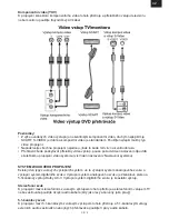 Preview for 5 page of Hyundai DV2H378DU User Manual