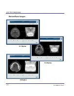 Preview for 56 page of i-CAT FLX V Series User Manual