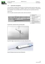 Предварительный просмотр 45 страницы IceCure ProSense DMS-7063 User Manual