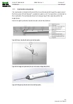 Preview for 46 page of IceCure ProSense FAS3100000 User Manual