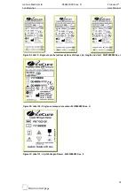 Preview for 31 page of IceCure ProSense User Manual