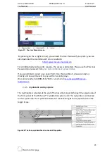 Preview for 43 page of IceCure ProSense User Manual