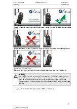 Preview for 65 page of IceCure ProSense User Manual