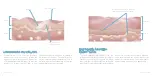 Preview for 4 page of ILUMINAGE SKIN SMOOTHING LASER Manual