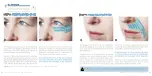 Preview for 25 page of ILUMINAGE SKIN SMOOTHING LASER Manual