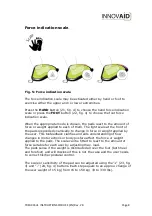 Preview for 9 page of Innovaid 920-999-000 Instructions For Use Manual