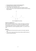 Предварительный просмотр 35 страницы INSIGHT Vital Signs Plus ECG Operator'S Manual