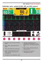 Предварительный просмотр 47 страницы Instramed CardioMax User Manual