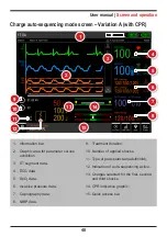 Предварительный просмотр 48 страницы Instramed DUALMAX User Manual