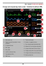 Предварительный просмотр 49 страницы Instramed DUALMAX User Manual