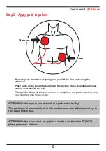 Предварительный просмотр 82 страницы Instramed DUALMAX User Manual