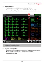 Предварительный просмотр 150 страницы Instramed DUALMAX User Manual