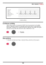 Предварительный просмотр 160 страницы Instramed DUALMAX User Manual