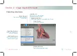 Preview for 15 page of INTELLIGENT ULTRASOUND HeartWorks AR User Manual