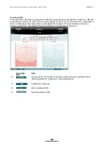 Preview for 161 page of Interacoustics AC40 Instructions For Use Manual