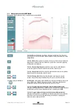 Preview for 280 page of Interacoustics Affinity2.0 Instructions For Use Manual