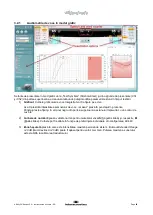 Preview for 393 page of Interacoustics Affinity2.0 Instructions For Use Manual