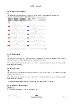 Предварительный просмотр 31 страницы Interacoustics Eclipse ABRIS Instructions For Use Manual