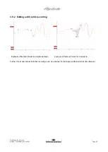 Предварительный просмотр 58 страницы Interacoustics Eclipse ABRIS Instructions For Use Manual