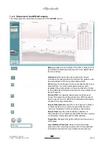 Предварительный просмотр 90 страницы Interacoustics Eclipse ABRIS Instructions For Use Manual