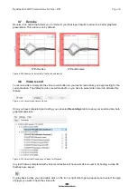 Preview for 43 page of Interacoustics EyeSeeCam Instructions For Use Manual