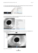 Preview for 45 page of Interacoustics EyeSeeCam Instructions For Use Manual