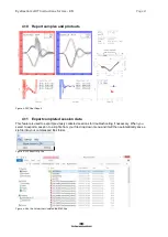 Preview for 48 page of Interacoustics EyeSeeCam Instructions For Use Manual