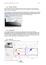 Preview for 134 page of Interacoustics EyeSeeCam Instructions For Use Manual