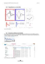 Preview for 148 page of Interacoustics EyeSeeCam Instructions For Use Manual