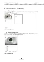 Preview for 225 page of Interacoustics EyeSeeCam Instructions For Use Manual