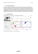 Preview for 235 page of Interacoustics EyeSeeCam Instructions For Use Manual