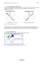 Preview for 238 page of Interacoustics EyeSeeCam Instructions For Use Manual