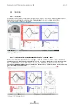 Preview for 289 page of Interacoustics EyeSeeCam Instructions For Use Manual