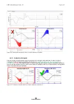 Preview for 337 page of Interacoustics EyeSeeCam Instructions For Use Manual