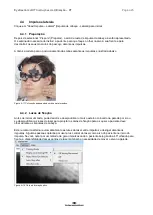 Preview for 385 page of Interacoustics EyeSeeCam Instructions For Use Manual