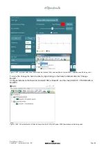 Preview for 50 page of Interacoustics VisualEyes 505 Instructions For Use Manual