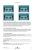 Preview for 75 page of Interacoustics VisualEyes 505 Instructions For Use Manual