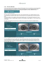 Preview for 80 page of Interacoustics VisualEyes 505 Instructions For Use Manual