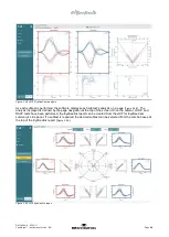 Preview for 94 page of Interacoustics VisualEyes 505 Instructions For Use Manual