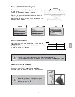 Preview for 72 page of Invacare ScanBed 750 User Manual