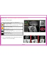 Preview for 20 page of Invivo UroNav Quick Reference Manual