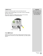 Предварительный просмотр 25 страницы Iridex EndoProbe Operator'S Manual