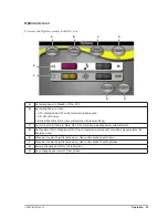 Preview for 27 page of Iridex IQ 532 Operator'S Manual