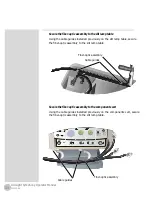 Preview for 36 page of Iridex OcuLight Symphony Operator'S Manual