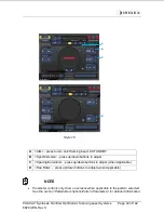 Preview for 49 page of Iridex PASCAL Synthesis TwinStar Operator'S Manual